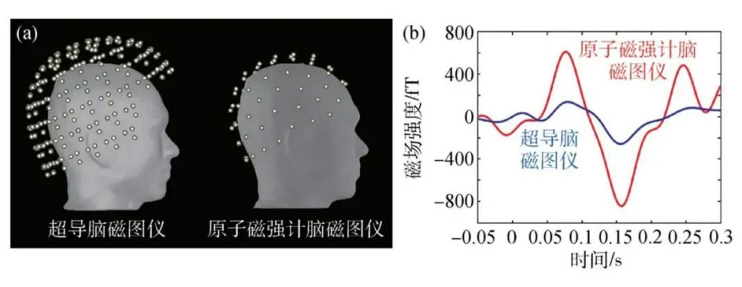 解密大腦活動(dòng)，腦磁圖引領(lǐng)腦科學(xué)研究新熱點(diǎn)